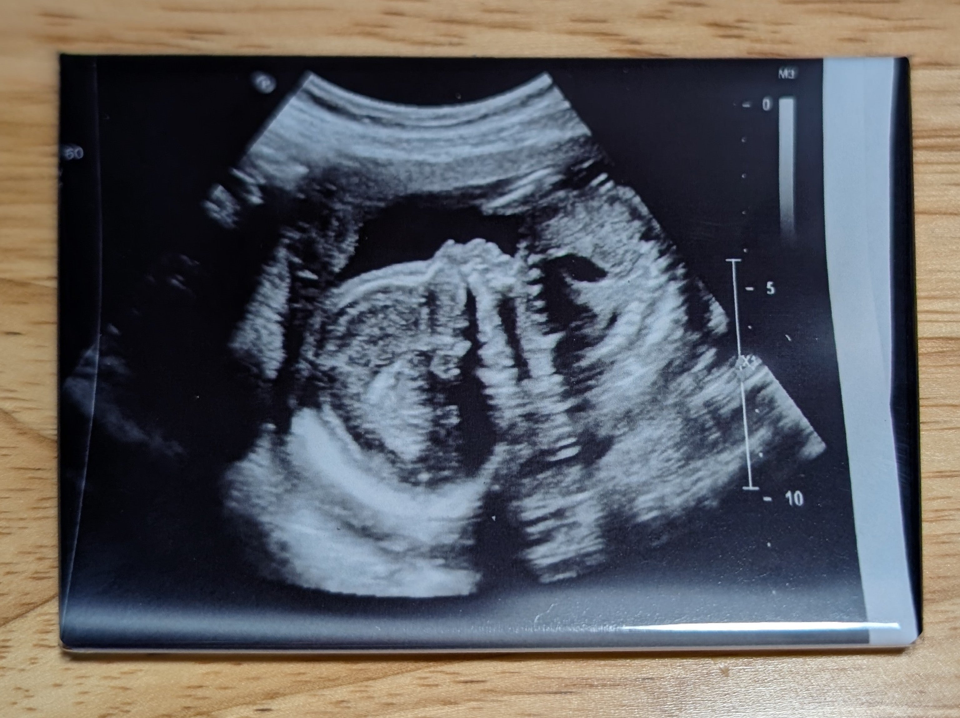 Custom Photo Magnets |2.5" x 3.5" Rectangle | 2.25" Round |